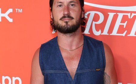 Dancing With the Stars' Val Chmerkovskiy Hospitalized During Tour