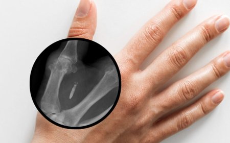 Mandatory Subcutaneous Microchips for Employees May Soon Be Banned in Washington State