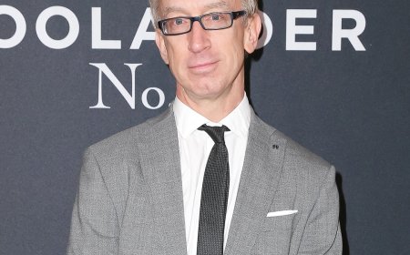 Andy Dick Has Multiple "Holes" in His Brain After Apparent Overdose