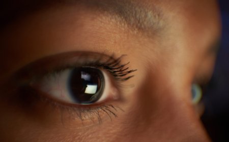 Why are vertebrate eyes so different from those of other animals?