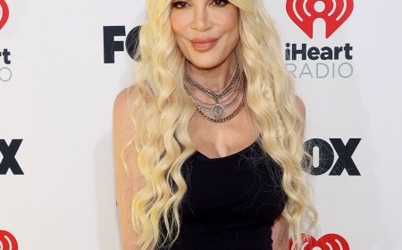 Tori Spelling Addresses Plastic Surgery Speculation