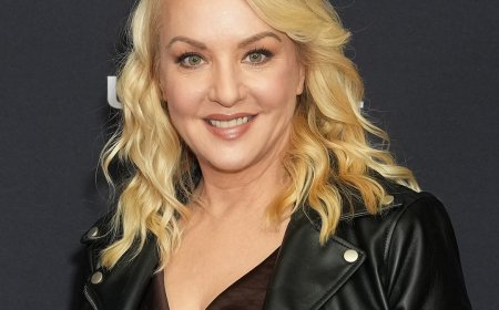 Wendi McLendon-Covey Shares Neck Lift Photo After Missing Oscars