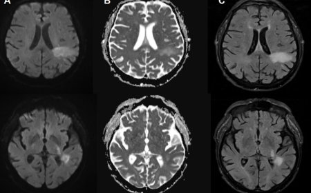 You're likely already infected with a brain-eating virus you've never heard of