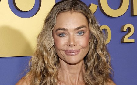 Denise Richards's plastic surgeon reveals stunning before-and-after photos of her facelift