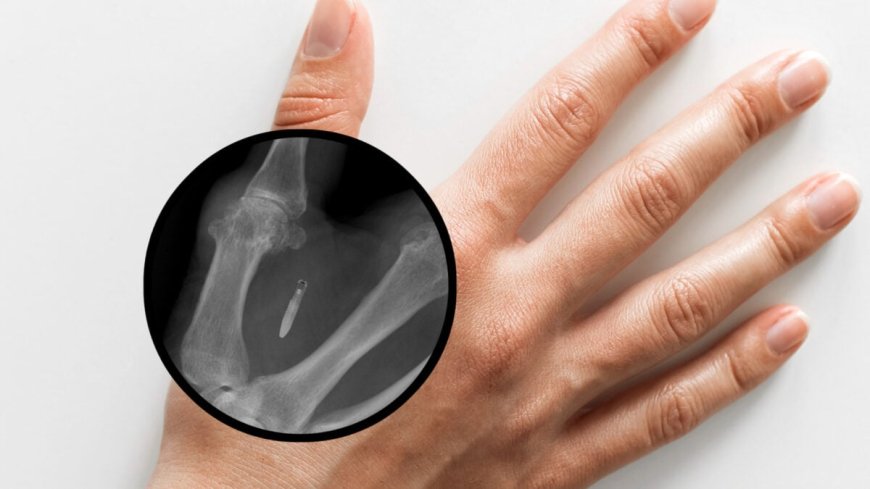 Mandatory Subcutaneous Microchips for Employees May Soon Be Banned in Washington State