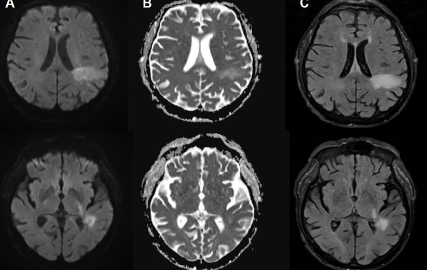 You're likely already infected with a brain-eating virus you've never heard of