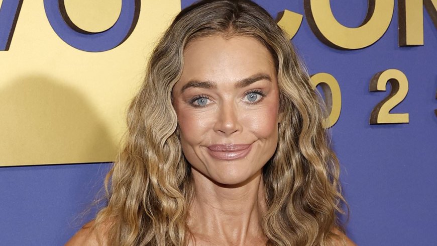 Denise Richards's plastic surgeon reveals stunning before-and-after photos of her facelift