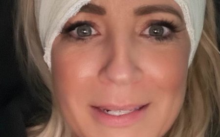 Carrie Bickmore shares terrifying update about her head injury as she reveals horrific life-threatening extent of her wound