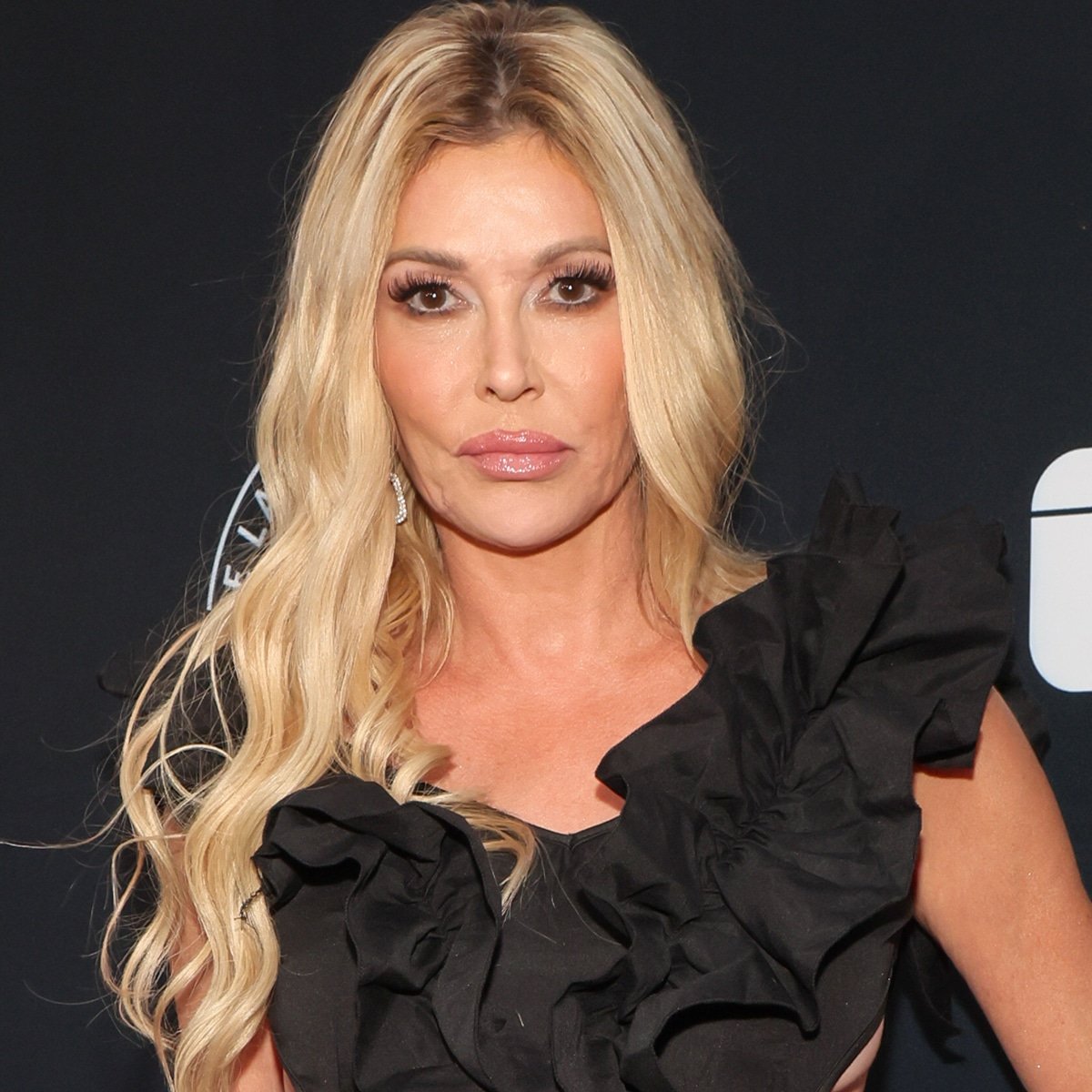 Brandi Glanville Shares She Has a Benign Tumor in Her Face