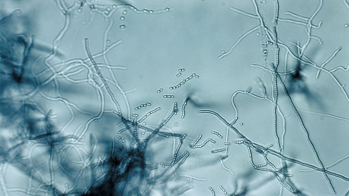 Antibiotic "megacluster" discovery provides new strategy to fight superbugs