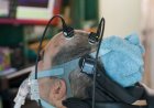AI and brain-computer interface allow speechless ALS patient to work a full-time job