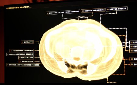Midjourney, the AI image generator, is developing a full-body ultrasonic scanner