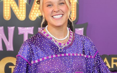 JoJo Siwa Details Suffering From "Gnarly" Eye Infection and Concussion