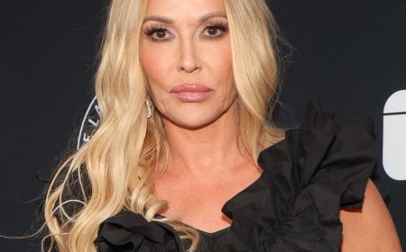 Brandi Glanville Shares She Has a Benign Tumor in Her Face