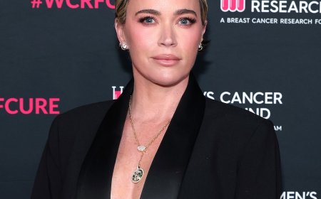 Teddi Mellencamp Shares Update on Immunotherapy Amid Cancer Journey