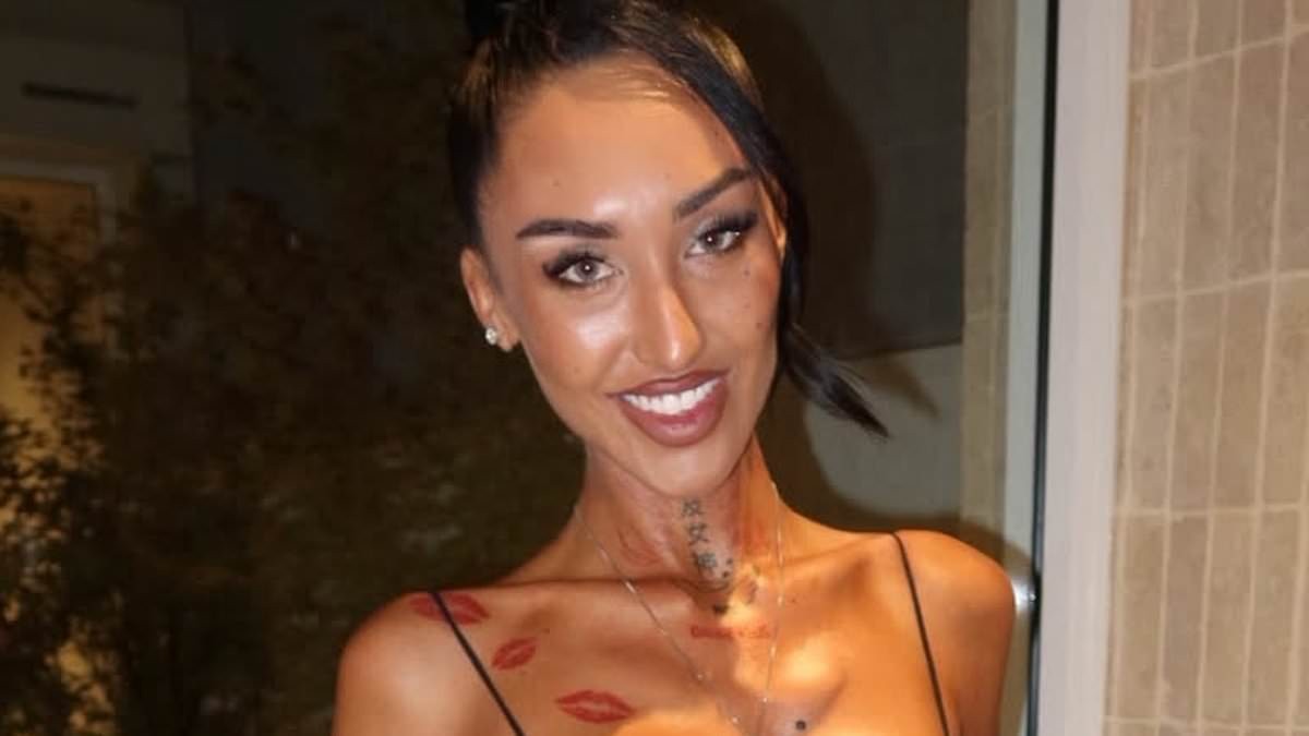 Fans share health fears for Australian influencer as she reveals the 'insane' results of the controversial Bali 'Barbie Waist' surgery