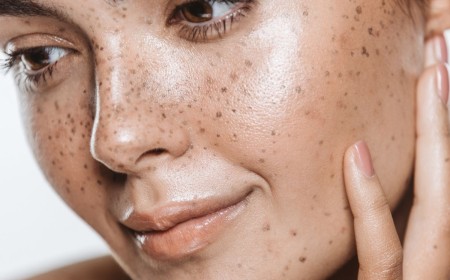 The Skin Treatments That Actually Boost Collagen After 25