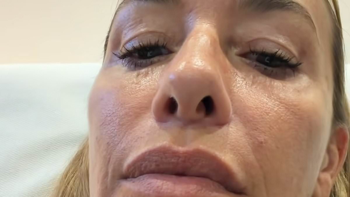 All Saints star Melanie Blatt, 51, reveals the results of £2,500 non-surgical facelift and says she'll try 'pretty much anything'