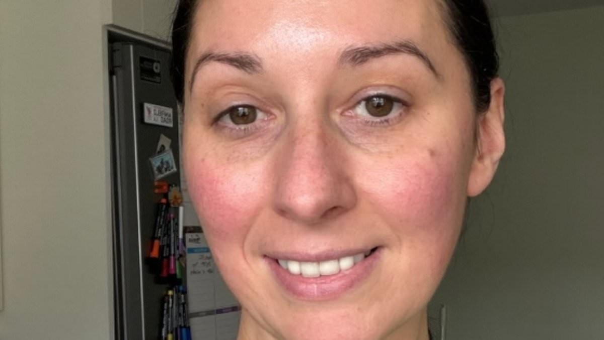 The Traitors star Rachel Duffy reveals she was rushed to hospital following horrific kitchen blender accident