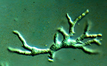 Toddler's tragic death from brain-destroying amoeba offers lessons for doctors