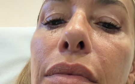 All Saints star Melanie Blatt, 51, reveals the results of £2,500 non-surgical facelift and says she'll try 'pretty much anything'