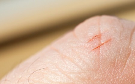Print management outfit PaperCut is under 0-day attack, and it’s drawing customers’ blood