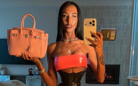 Australian influencer who underwent controversial Bali 'Barbie Waist' surgery shows what she used to look like after revealing the 'insane' results of her procedure