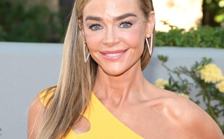 Denise Richards Details All the Plastic Surgery Procedures on Her Face