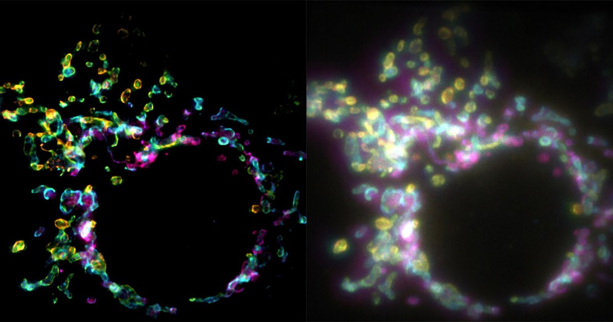 A New Super-Resolution Microscopy Technique Lets Scientists Study Cells In Real Time