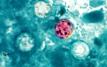 Trump admin shelves Cyclospora research despite record-breaking outbreak