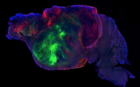 Researchers swap in human brain cells for a mouse's cortex