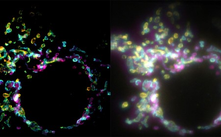 A New Super-Resolution Microscopy Technique Lets Scientists Study Cells In Real Time