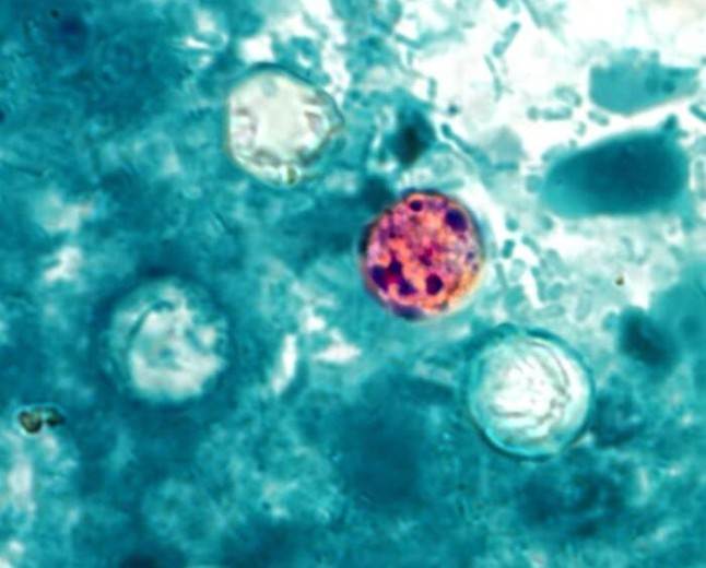 Trump admin shelves Cyclospora research despite record-breaking outbreak