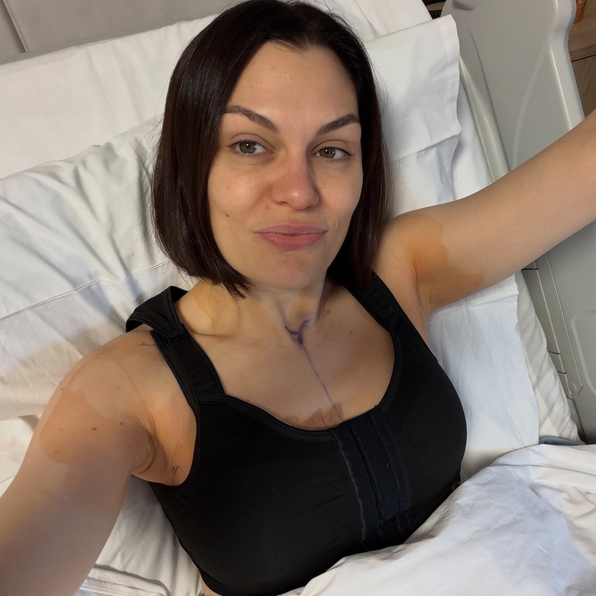 Jessie J Shares Update After 2nd Breast Cancer Reconstruction Surgery