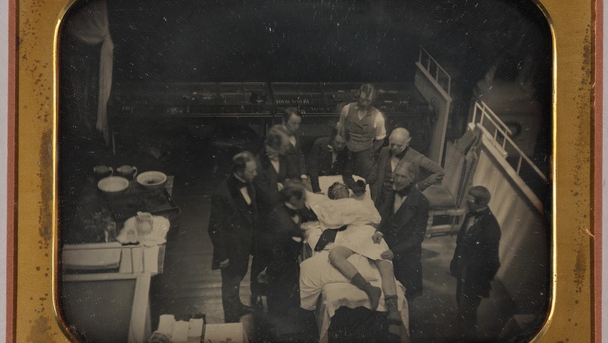 This Famous Ether Daguerreotype Shows the Wrong Patient