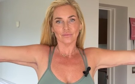 Josie Gibson gives an update on her scars after having an £8,000 arm lift amid lipoedema battle - as she reveals plans to have three more surgeries on her legs