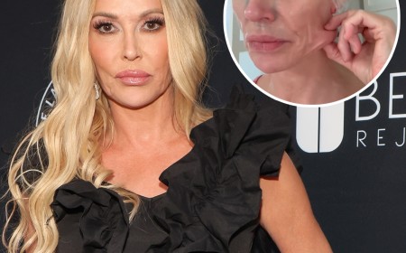 Brandi Glanville Getting Surgery to Find Out What's "Eating" Her Face