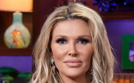 Brandi Glanville suffers more heartbreak amid facial disfigurement battle as she reveals her father has died: 'I hate this life right now'