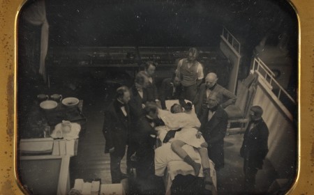This Famous Ether Daguerreotype Shows the Wrong Patient
