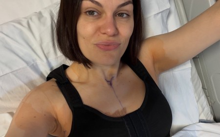 Jessie J Shares Update After 2nd Breast Cancer Reconstruction Surgery