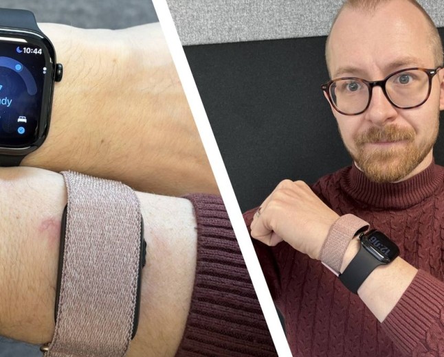 Apple Watch Series 12 vs Garmin Cirqa for one week — sleep scores compared
